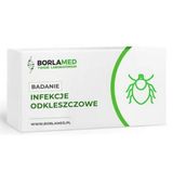 Przeciwciała p-c Borrelia burgdorferi IgM lub IgG metoda Western-blot
