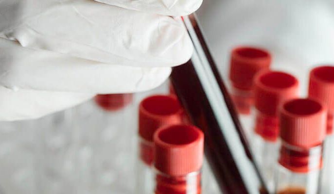 Kiedy zrobić morfologię krwi?