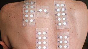 Testy kontaktowe płatkowe - standard europejski