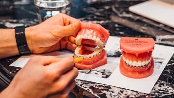 Konsultacja ortodontyczna