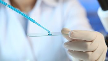 Cytologia płynna (LBC) szyjki macicy z pobraniem w Centrum Medycznym