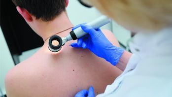 Znamiona pod kontrolą – wideodermatoskopia