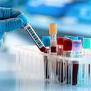 Test DNA MyHealth: Odkryj ryzyko chorób
