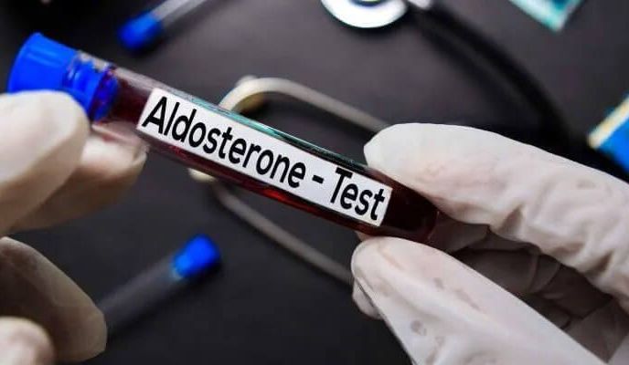 Aldosteron – badanie hormonu nadnerczy, normy