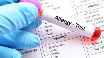Test Alex 2 – diagnostyka molekularna chorób alergicznych